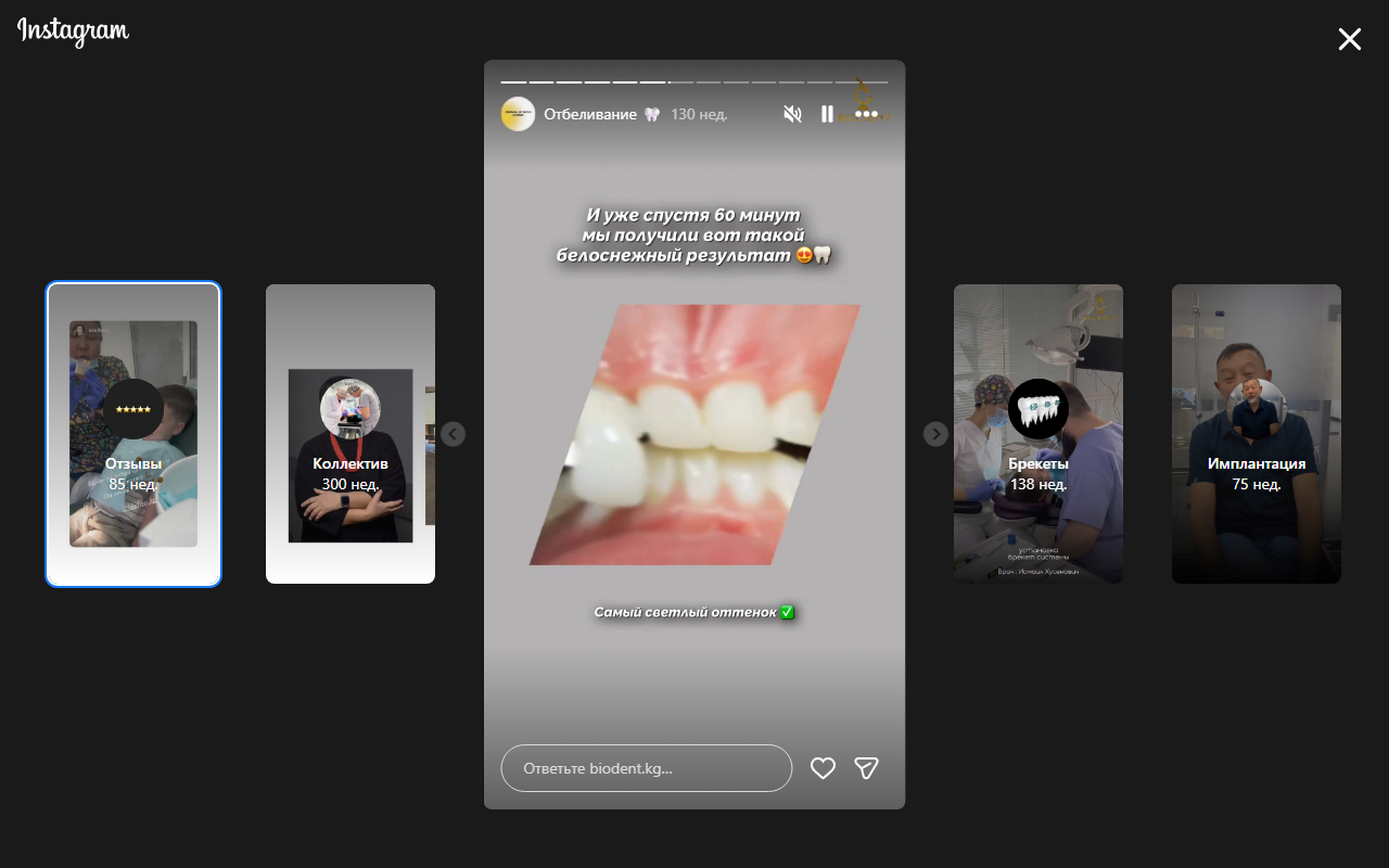 Отбеливание зубов — результат