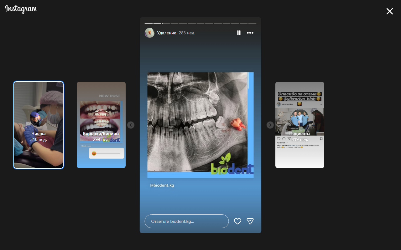 Цифровой рентген в клинике Biodent