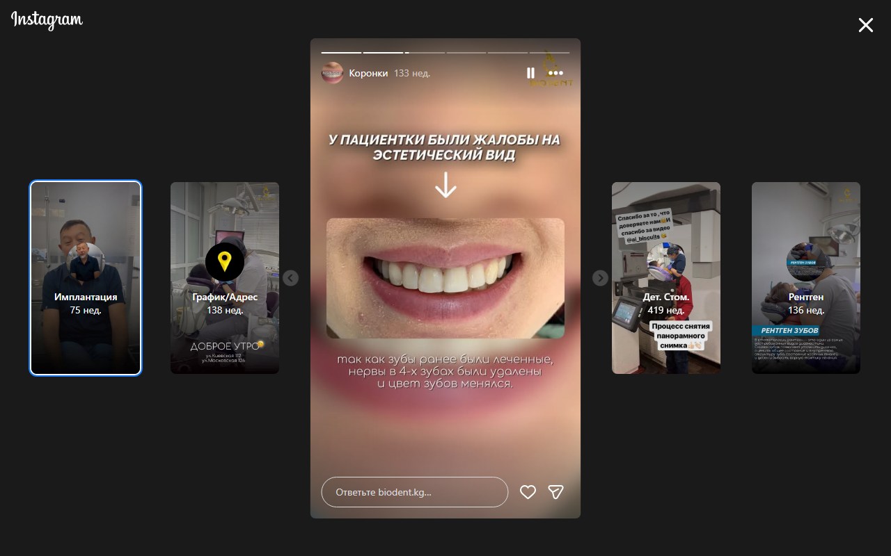 После установки циркониевых коронок