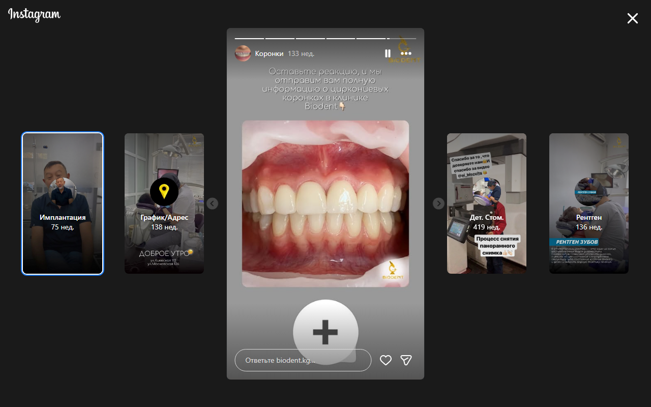 Результат работы клиники Biodent — белоснежная улыбка