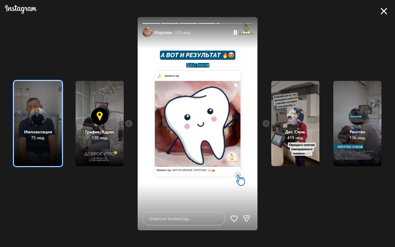 До установки коронок